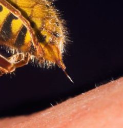 درمان خانگی نیش زنبور عسل