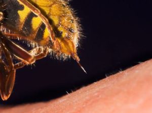 درمان خانگی نیش زنبور عسل